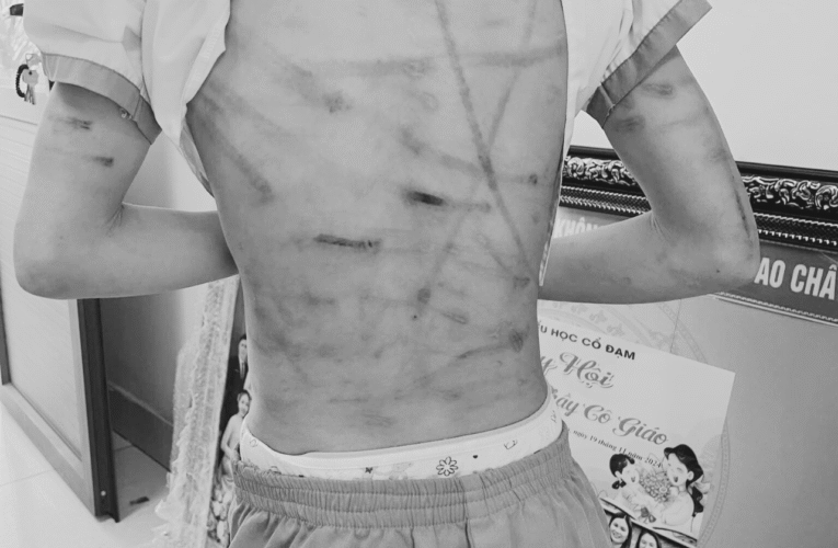 Hình ảnh cháu lớp 5 ở Hà Tĩnh bị baohanh