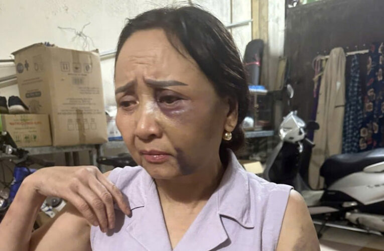 Cần làm rõ, xử lý nghiêm đối tượng vô cớ hành hung một phụ nữ cao tuổi gãy 5 xương sườn
